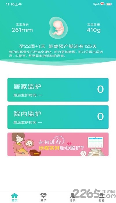 胎心监护