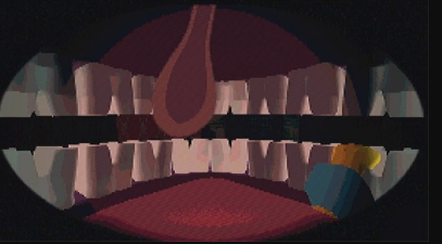 扁桃体惊魂(Tonsil Terror)